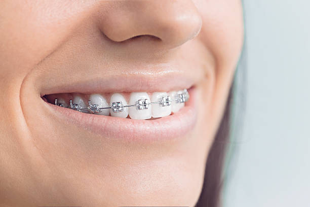 Best Traditional Braces  in Atwater, CA